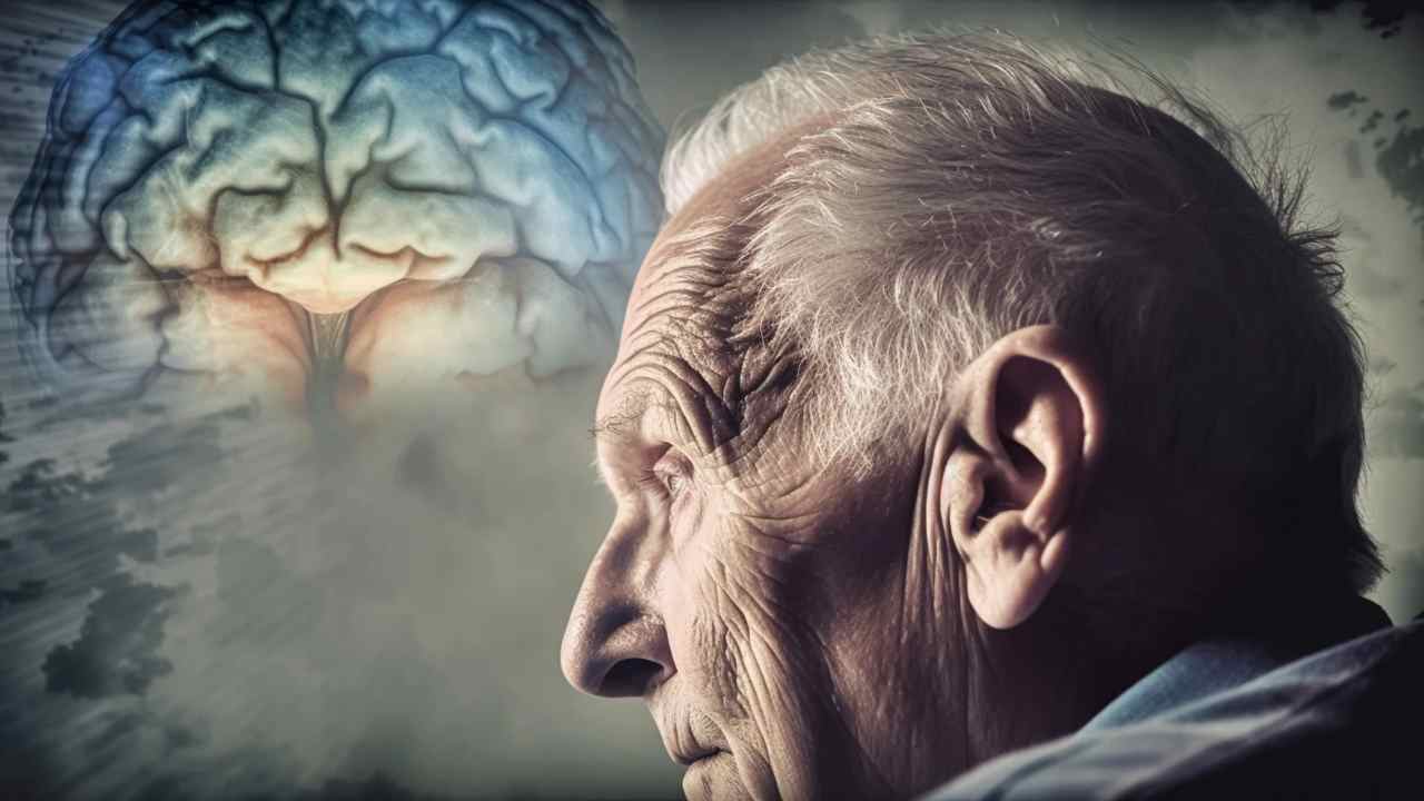 malattia di Alzheimer